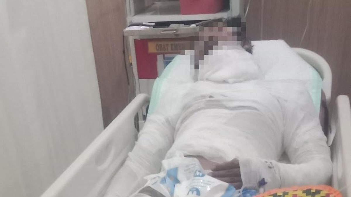 Sopir Truk di Bali Terbakar Hidup-hidup oleh Atasannya Terkait Uang Setoran